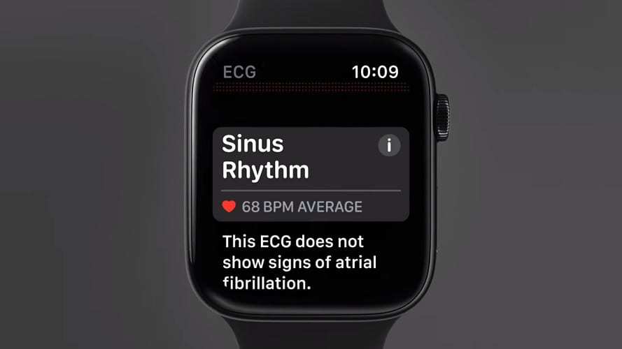 New Apple Watch Is More Than Your Average Wearable