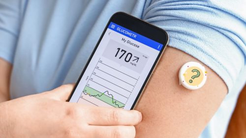 Wearable technology - Blood Glucose Tracking gadget