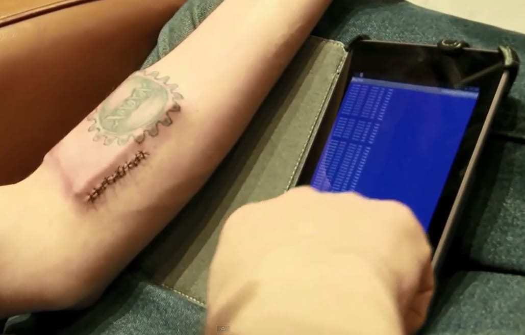 biohacker gadgets in body